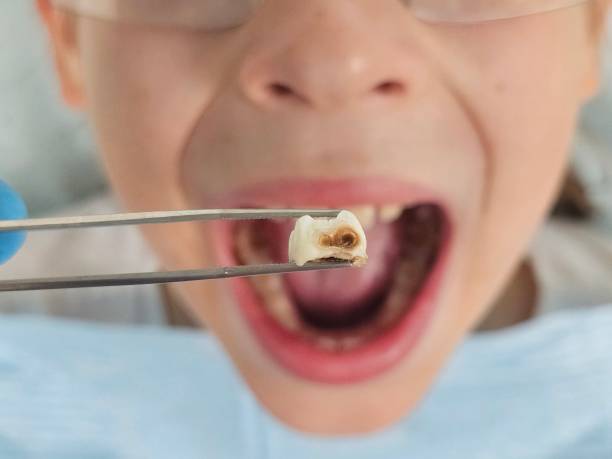Best Emergency Dental Care for Abscessed Tooth in Malvern, IA